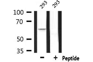 Western blot analysis of extracts from 293, using CERKL Antibody. (CERKL anticorps  (Internal Region))