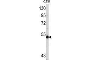 Western blot analysis of MYCN antibody (C-term) in CEM cell line lysates (35ug/lane). (MYCN anticorps  (C-Term))