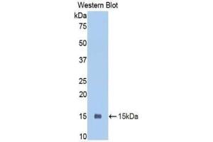 Western blot analysis of the recombinant protein. (PIGR anticorps  (AA 352-457))