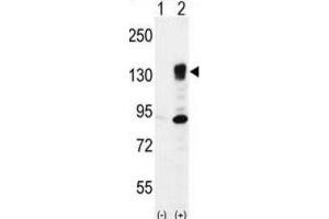 Western Blotting (WB) image for anti-Integrin, alpha 5 (ITGA5) antibody (ABIN2996588) (ITGA5 anticorps)