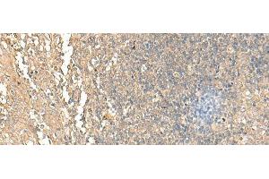 Immunohistochemistry of paraffin-embedded Human tonsil tissue using NARS Polyclonal Antibody at dilution of 1:55(x200) (NARS anticorps)