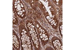Immunohistochemical staining of human rectum with INO80D polyclonal antibody  shows strong cytoplasmic positivity in glandular cells. (IN80D anticorps)