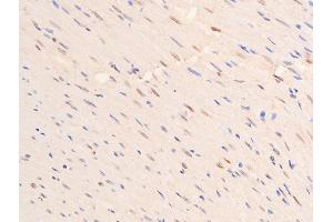 ABIN6267288 at 1/100 staining rat heart tissue sections by IHC-P.