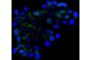 IF analysis of RICTOR using anti-RICTOR antibody (ABIN7600744). (RICTOR anticorps  (AA 23-264))