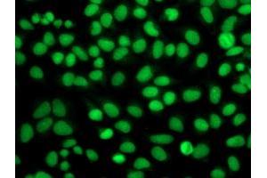 Immunofluorescent staining of HeLa cells using anti-FGFR2 mouse monoclonal antibody (ABIN2454529). (FGFR2 anticorps)