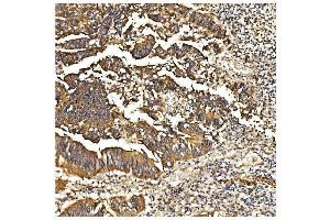 IHC analysis of PDE6 beta/PDE6B using anti-PDE6 beta/PDE6B antibody (ABIN7600894).