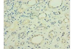 Immunohistochemistry of paraffin-embedded human kidney tissue using ABIN7153466 at dilution of 1:100 (Galectin 9 anticorps  (AA 1-240))