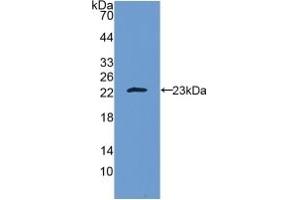 Detection of Recombinant IL10, Human using Polyclonal Antibody to Interleukin 10 (IL10) (IL-10 anticorps  (AA 19-178))