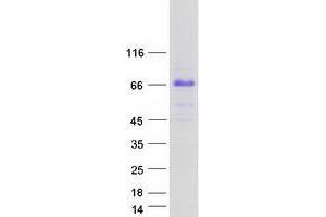Validation with Western Blot