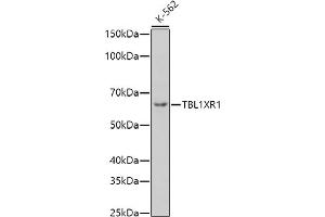 Western blot analysis of extracts of K-562 cells, using TBL1XR1 antibody (ABIN6132717, ABIN6148893, ABIN6148895 and ABIN6217436) at 1:1000 dilution. (TBL1XR1 anticorps  (AA 1-180))