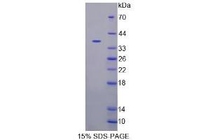 SDS-PAGE analysis of Mouse CASQ2 Protein. (CASQ2 Protéine)