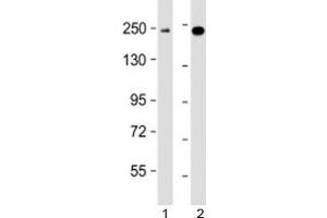 Western blot testing of human 1) K562 and 2) MCF7 cell lysate with XRN1 antibody at 1:2000. (XRN1 anticorps  (AA 1455-1706))