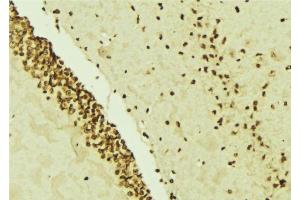 ABIN6276539 at 1/100 staining Mouse brain tissue by IHC-P.