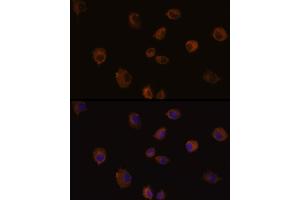Immunofluorescence analysis of C6 cells using MMP13 Rabbit pAb (ABIN6130559, ABIN6143903, ABIN6143904 and ABIN6215450) at dilution of 1:100 (40x lens).