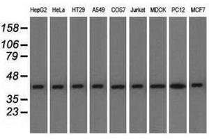 Image no. 4 for anti-Acetyl-CoA Acetyltransferase 2 (ACAT2) antibody (ABIN1496404)