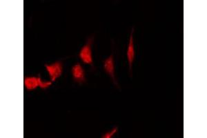 anti-FGFR1 Oncogene Partner (FGFR1OP) (C-Term) antibody