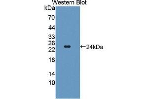 Western blot analysis of the recombinant protein. (TWSG1 anticorps  (AA 26-223))