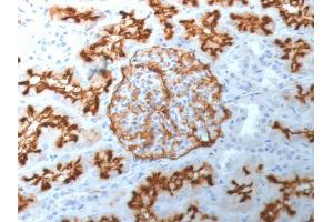 Formalin-fixed, paraffin-embedded human Kidney stained with CD10 Mouse Monoclonal Antibody (MME/1892).