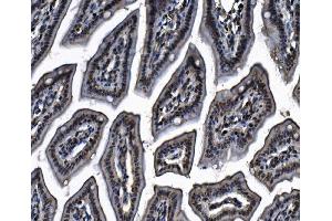IHC analysis of MCM4 using anti-MCM4 antibody (ABIN7601485).