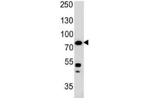 Western blot testing of human HT29 cell lysate with Moesin antibody (clone MSN/491). (Moesin anticorps)