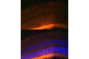 Immunofluorescence analysis of mouse retina using GRK1 Polyclonal Antibody (ABIN6134352, ABIN6141414 and ABIN7101798) at dilution of 1:100 (40x lens).