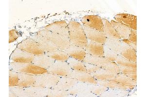 Phospho-A20/TNFAIP3 (Ser381) Antibody at 1/100 staining Rat muscle tissue by IHC-P. (TNFAIP3 anticorps  (pSer381))