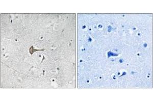 Immunohistochemistry analysis of paraffin-embedded human brain tissue, using Kv4. (KCND2 anticorps  (AA 581-630))