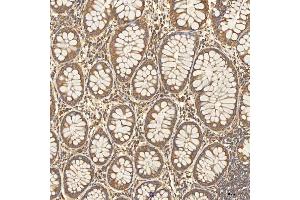 IHC analysis of Citrin/SLC25A13 using anti-Citrin/SLC25A13 antibody (ABIN7599512). (slc25a13 anticorps  (AA 1-643))