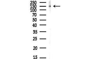 anti-Eukaryotic Translation Initiation Factor 2-alpha Kinase 3 (EIF2AK3) (pSer715) antibody