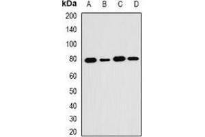 Western blot analysis of SH2B1 expression in HT29 (A), MCF7 (B), mouse kidney (C), mouse brain (D) whole cell lysates. (SH2B1 anticorps)