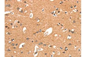 The image on the left is immunohistochemistry of paraffin-embedded Human brain tissue using ABIN7189890(ARHGAP4 Antibody) at dilution 1/25, on the right is treated with synthetic peptide. (ARHGAP4 anticorps)