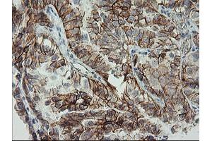 Immunohistochemistry (IHC) image for anti-Cadherin 2 (CDH2) antibody (ABIN1499625) (N-Cadherin anticorps)