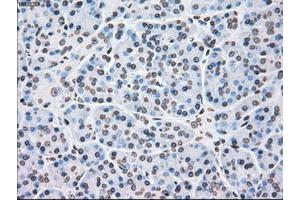 Image no. 6 for anti-Polo-Like Kinase 1 (PLK1) antibody (ABIN1500281)