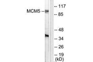 Western blot analysis of extracts from HepG2 cells, using MCM5 Antibody. (MCM5 anticorps  (AA 21-70))