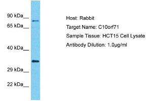 Host: Rabbit Target Name: C10orf71 Sample Type: HCT15 Whole cell lysates Antibody Dilution: 1. (C10ORF71 anticorps  (C-Term))