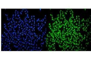 IF analysis of SMARCA2/BRM using anti-SMARCA2/BRM antibody (ABIN7600366).