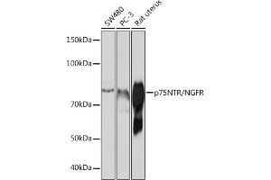 Western blot analysis of extracts of various cell lines, using p75NTR/NGFR antibody (ABIN7268850) at 1:1000 dilution. (NGFR anticorps)