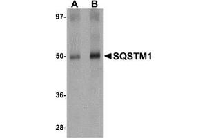 AP20066PU-N SQSTM1 antibody staining of Human Spleen Tissue Lysate by Western Blotting at (A) 1 and (B) 2 μg/ml. (SQSTM1 anticorps  (C-Term))