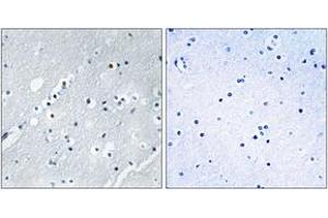 Immunohistochemistry analysis of paraffin-embedded human brain tissue, using Histone H2B Antibody.