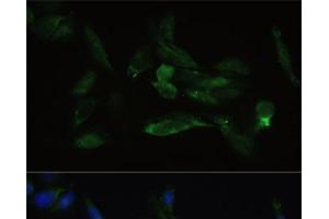 Immunofluorescence analysis of U2OS cells using TGFBR2 Polyclonal Antibody at dilution of 1:100. (TGFBR2 anticorps)
