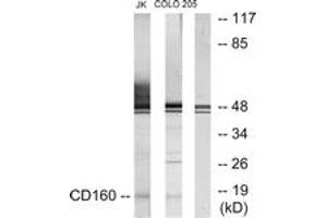 Western blot analysis of extracts from Jurkat/COLO205 cells, using CD160 Antibody. (CD160 anticorps  (AA 21-70))