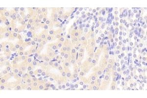Detection of FADD in Mouse Kidney Tissue using Polyclonal Antibody to Fas Associating Death Domain Containing Protein (FADD) (FADD anticorps  (AA 7-178))