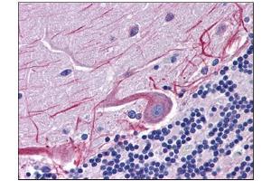 Human Brain, Cerebellum: Formalin-Fixed, Paraffin-Embedded (FFPE) (SKA1 anticorps  (C-Term))