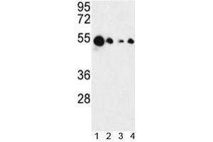 Western blot analysis of AIM2 antibody and 1) MCF-7, 2) HL-60, 3) K562 and 4) HeLa lysate. (AIM2 anticorps  (AA 1-50))