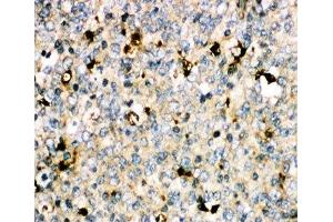 IHC-P: MyD88 antibody testing of human tonsil tissue