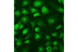 IF analysis of SUFU using anti-SUFU antibody (ABIN7601394). (SUFUH anticorps  (AA 34-484))