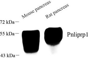 Western blot analysis of Pnliprp1 (ABIN7074981) at dilution of 1: 1000 (PNLIPRP1 anticorps)