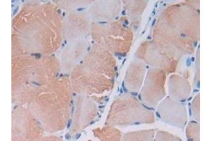 Detection of MYLK2 in Mouse Skeletal muscle Tissue using Polyclonal Antibody to Myosin Light Chain Kinase 2 (MYLK2)