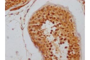 IHC image of ABIN7127796 diluted at 1:100 and staining in paraffin-embedded human testis tissue performed on a Leica BondTM system.