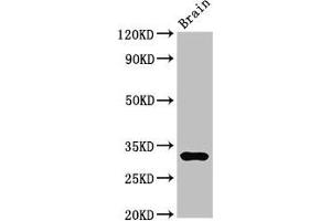 Western Blot Positive WB detected in: Mouse brain tissue All lanes: DNASE1 antibody at 3 μg/mL Secondary Goat polyclonal to rabbit IgG at 1/50000 dilution Predicted band size: 32, 20 kDa Observed band size: 32 kDa (DNASE1 anticorps  (AA 78-231))